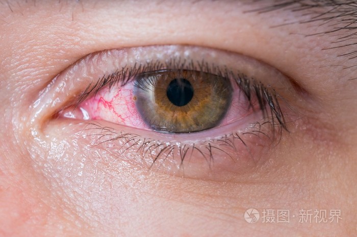 美图秀秀的红眼效果在哪里_美图秀秀有没有去红眼功能_美图秀秀p红眼教程